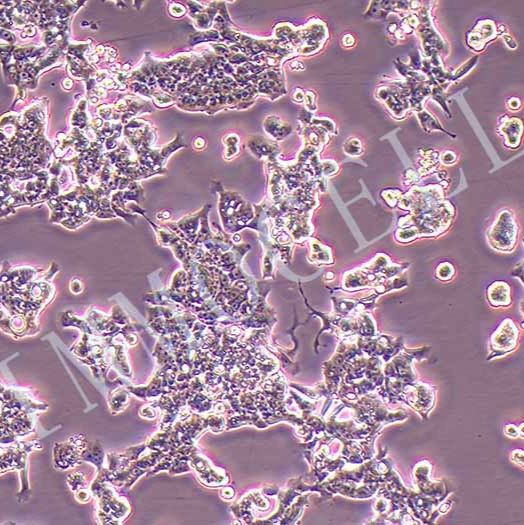LOVO人结肠癌细胞丨LOVO细胞(STR鉴定)