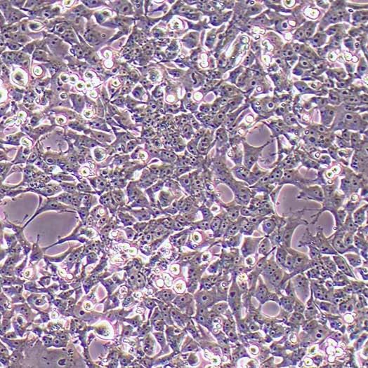 293FT人胚肾细胞丨293FT细胞株丨逸漠(immocell)