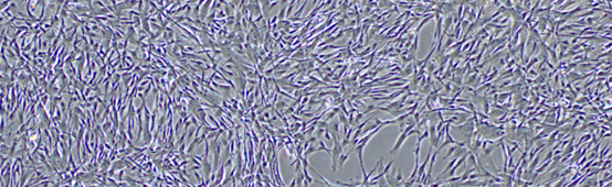 间充质干细胞成脂诱导注意事项