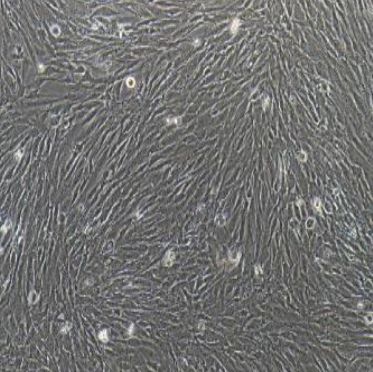 大鼠海绵体内皮细胞永生化