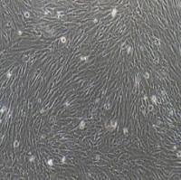 人非小细胞肺癌细胞+luc