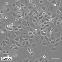YAC-1小鼠淋巴瘤细胞(NK靶细胞)