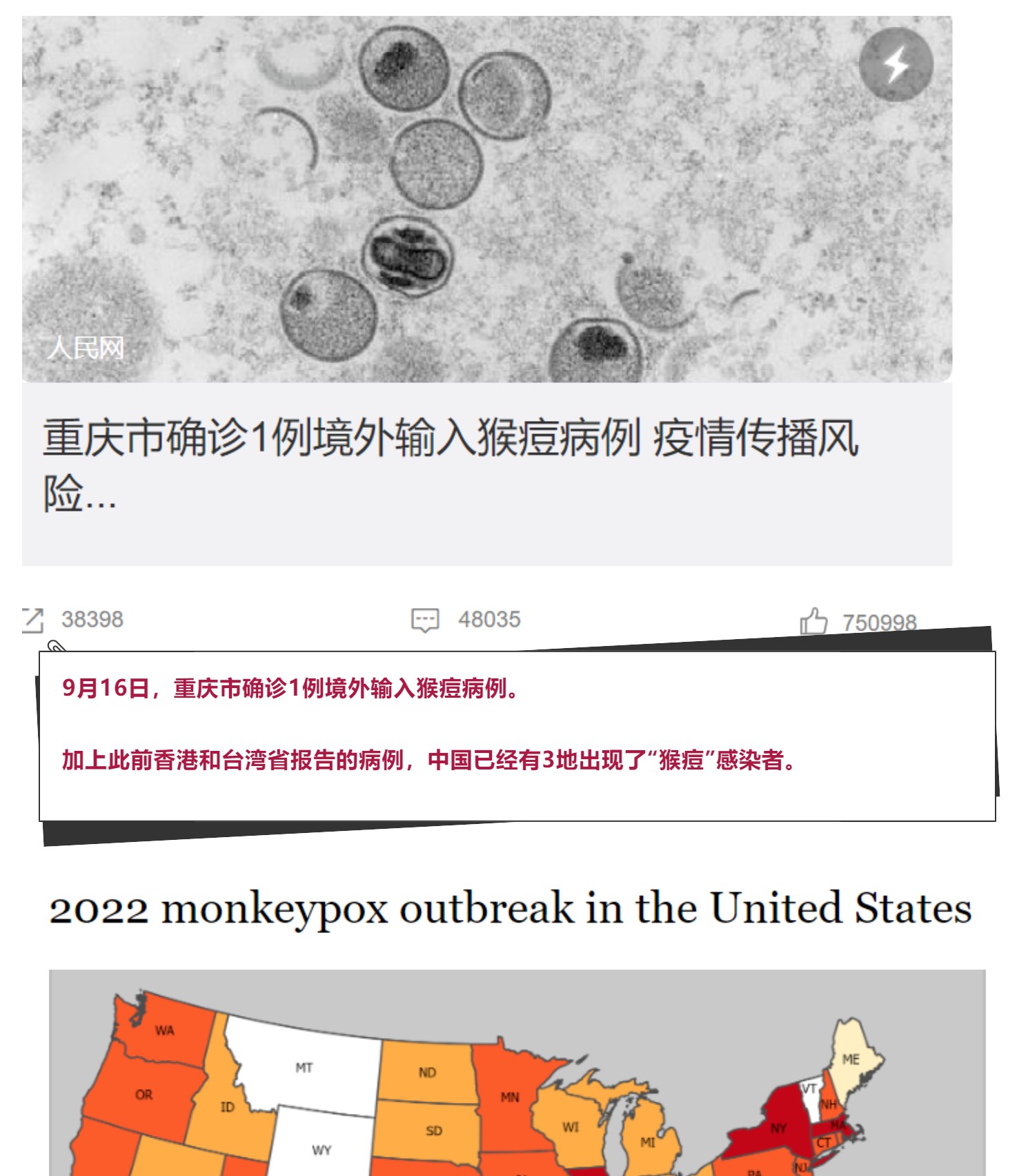 猴痘进入中国！迈迪安全力助力猴痘诊断！