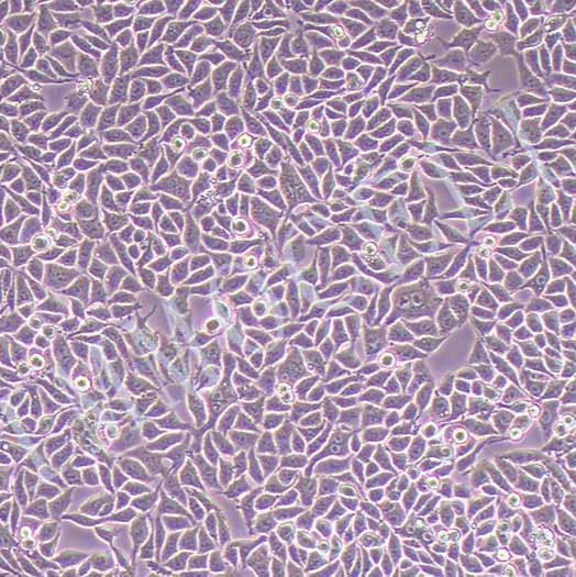 P53R人结直肠癌细胞(STR鉴定)