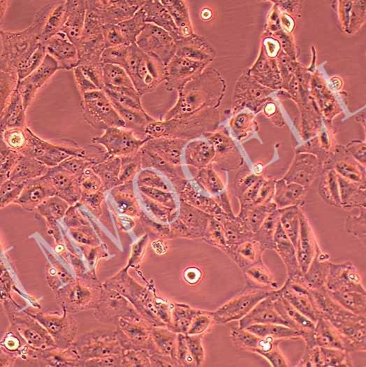 Caki-2人肾透明细胞癌细胞丨Caki-2细胞株(immocell)