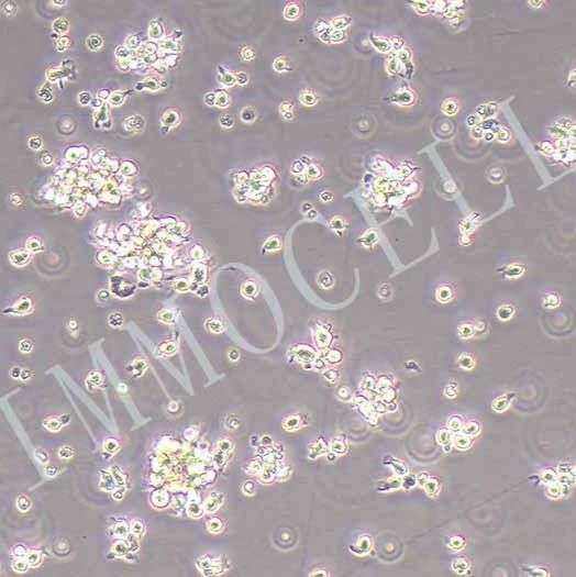 SU-DHL-4人B淋巴瘤细胞丨SU-DHL-4细胞株丨逸漠(immocell)