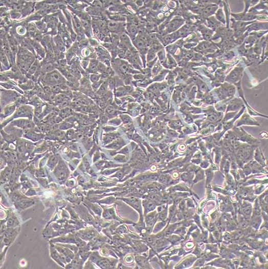 NCI-H358人非小细胞肺癌细胞丨NCI-H358细胞(含STR)