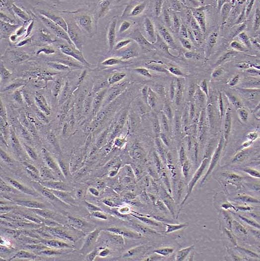 ARPE-19/HPV-16 人视网膜上皮细胞丨arpe19细胞丨逸漠