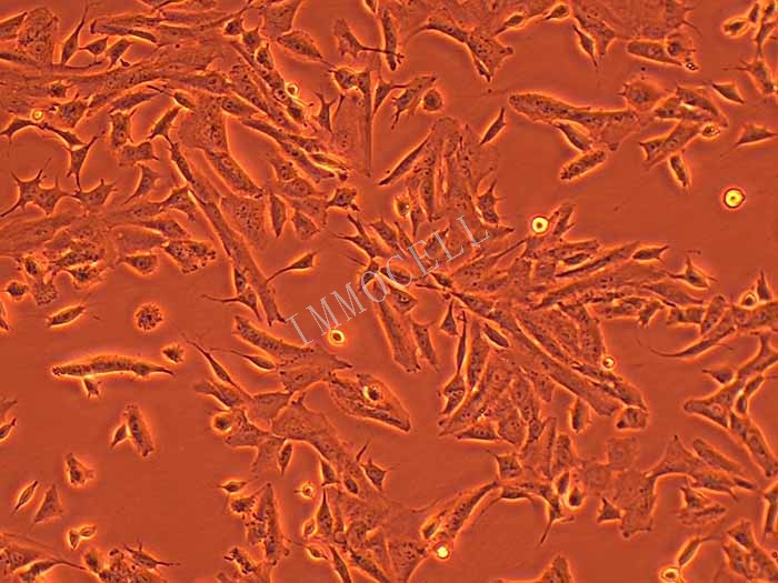 SK-N-SH人神经母细胞瘤细胞丨SK-N-SH细胞株丨ST