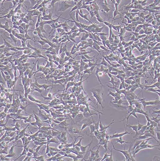 SH-SY5Y 人神经母细胞瘤细胞丨SH-SY5Y 细胞系报价