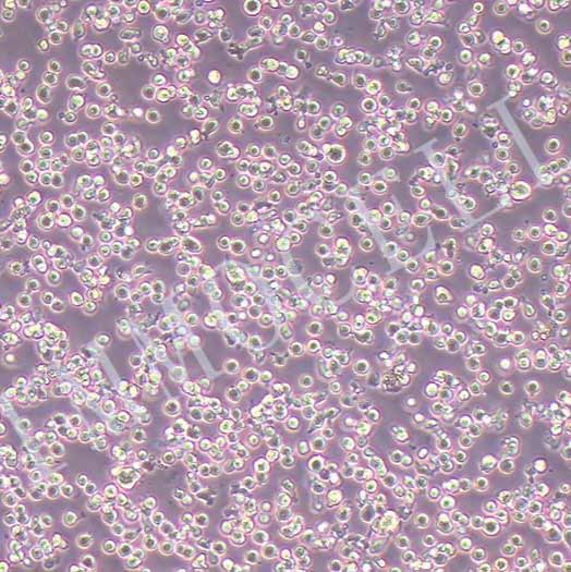 KG-1急性髓系细胞白血病细胞丨kg1细胞