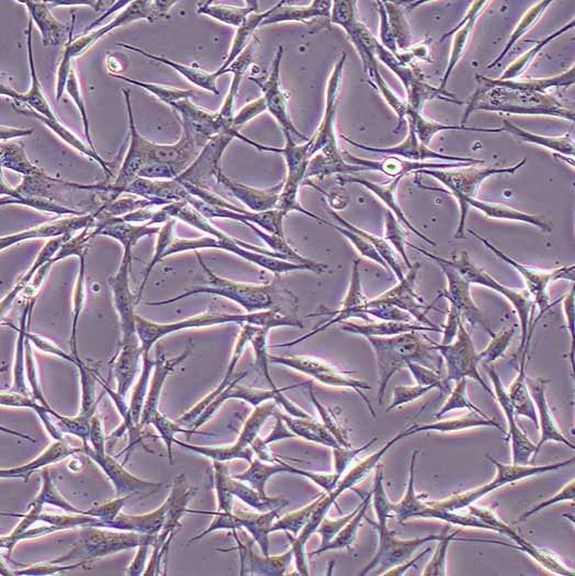 WM-115人恶性黑色素瘤细胞丨wm-115细胞系 价格丨STR图谱鉴定