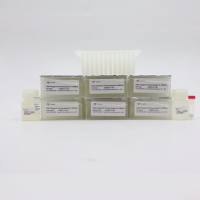 磁珠法病原微生物DNA提取试剂盒 VAMNE Magnetic Pathogen DNA Kit (KF Prepackaged)（DM203）