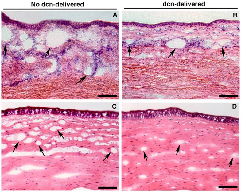 AAV在治疗肿瘤疾病方面的应用