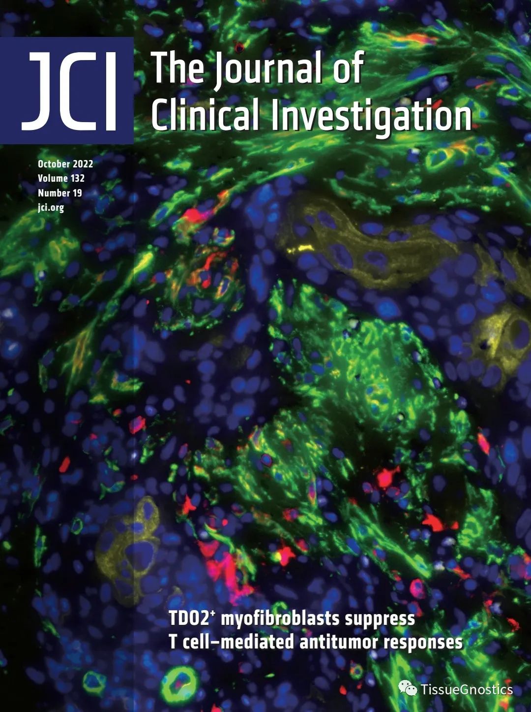 JCI封面文章| 中山大学北京大学联合揭示口腔肿瘤免疫逃逸机制和新的治疗靶点