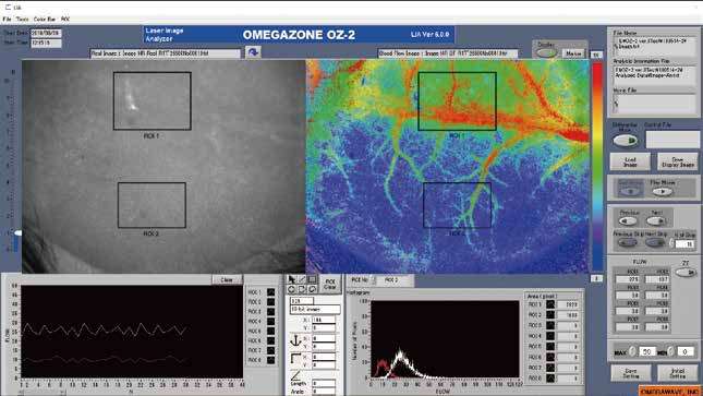 Omegawave OZ-2激光散斑血流成像系统