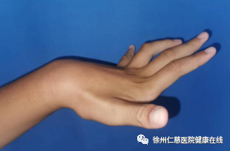 手指麻木，爪形手畸形，出现这些症状一定要小心