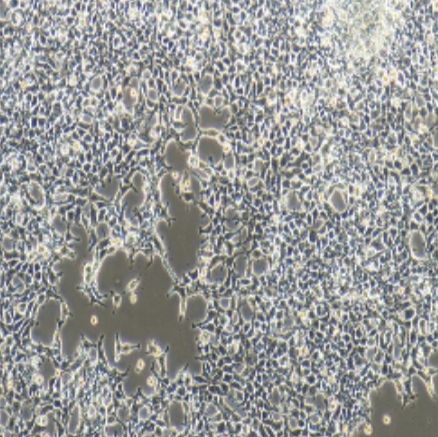 人胚肾上皮细胞（293A）