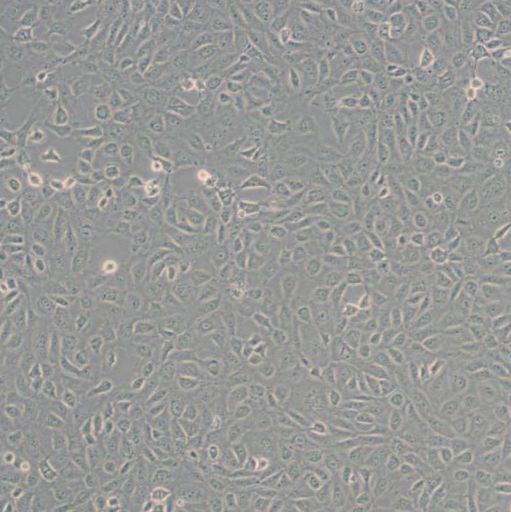 人视网膜上皮细胞(ARPE-19)