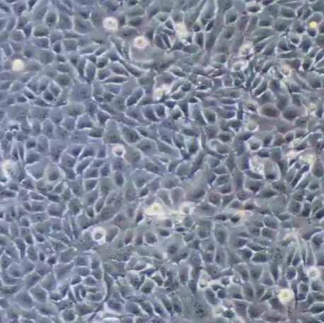 人骨肉瘤细胞(143B)