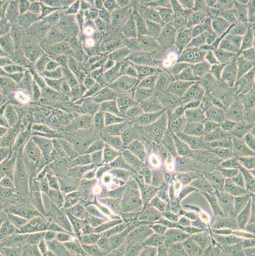 大鼠胶质肉瘤细胞(9L/lacZ)