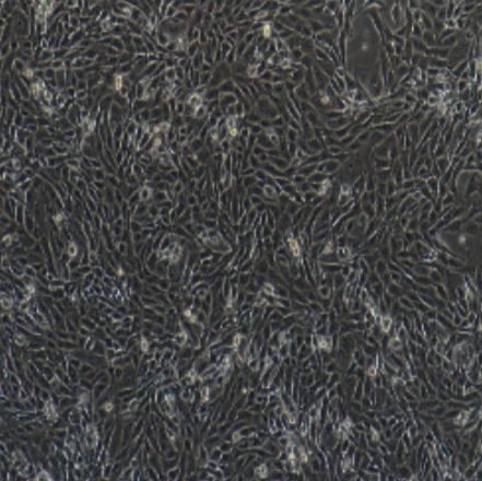小鼠气道平滑肌细胞（ASMC）