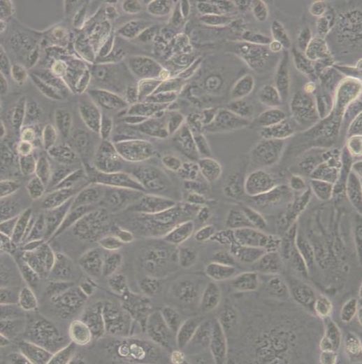 人骨髓浆细胞瘤株（AMO-1）