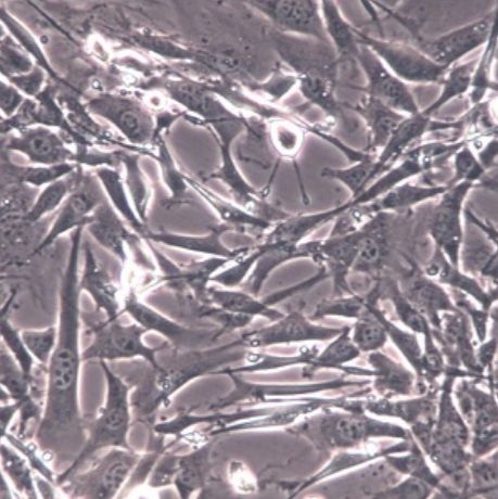 小鼠胚胎成纤维细胞(3T3-L1)