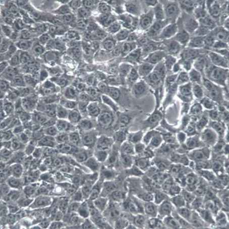 小鼠乳腺癌细胞(4T1)