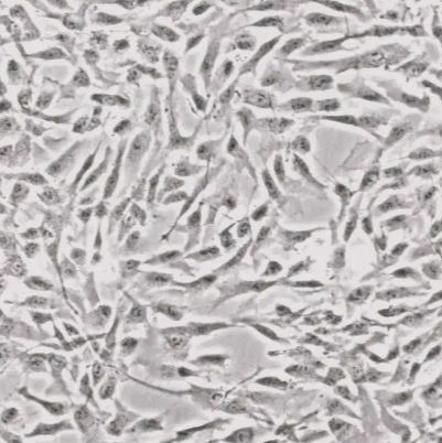 人支气管上皮细胞(16HBE HBE135-E6E7)