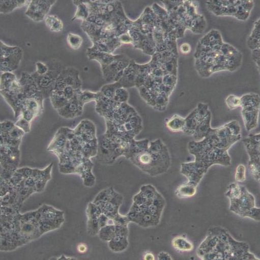 小鼠胰岛素瘤胰岛Beta细胞（BETA-TC-6）