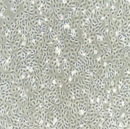 人膀胱癌细胞(5637)