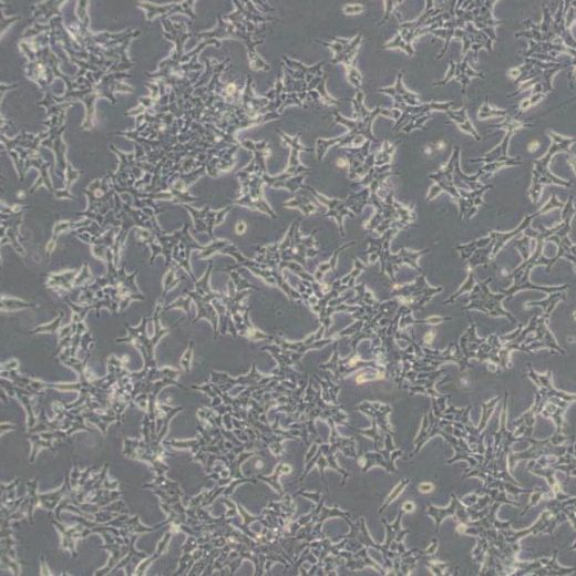 人前列腺癌细胞（22Rv1）