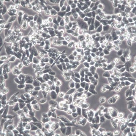 人卵巢癌细胞（A2780）