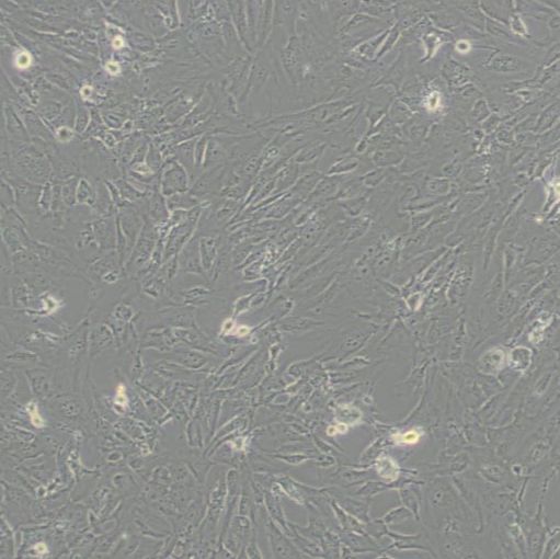 人SV40转染成骨细胞 (hFOB 1.19)