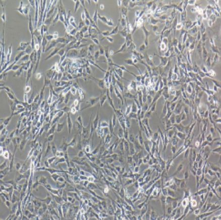 永生化人脑微血管内皮细胞（hCMEC/D3 ）