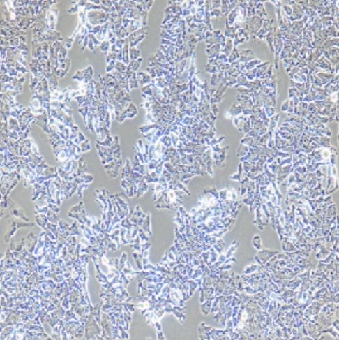 人肝癌细胞（huh-7.5.1）