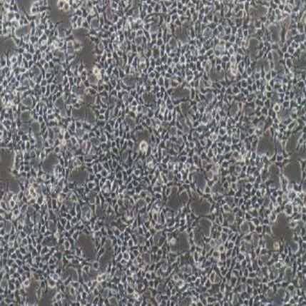 人肾上皮细胞（HKb20）