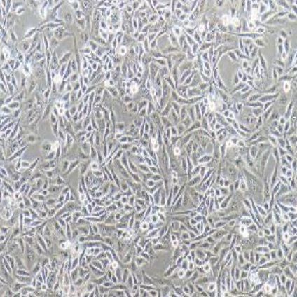 人腺癌细胞系（F56）