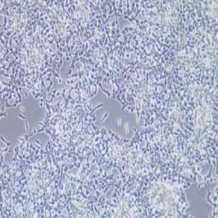 大鼠胰岛细胞瘤细胞(INS-1)