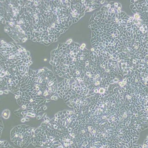 人结肠腺癌细胞（CX-1）