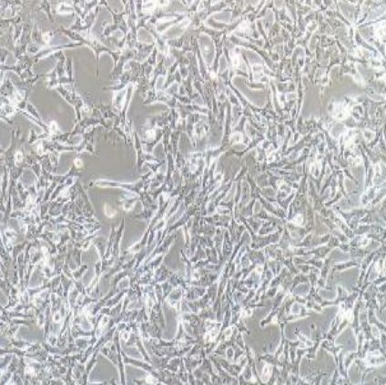 小鼠肝癌细胞(hepa1-6)