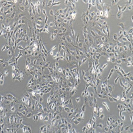 人前列腺癌细胞（DU145）