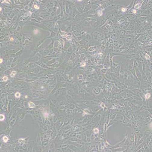 人肝星状细胞(LX-2)