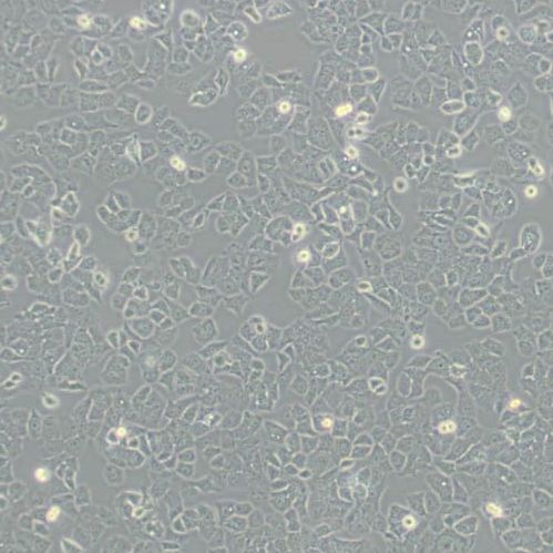 人子宫内膜癌细胞(Ishikawa)