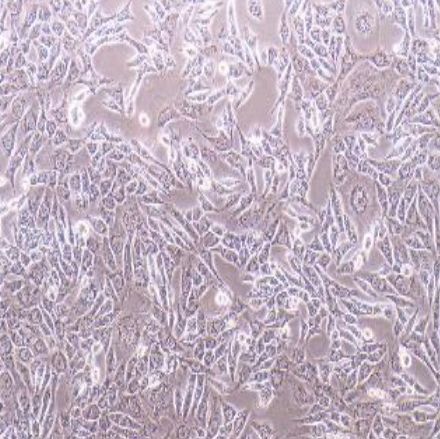 小鼠卵巢上皮癌细胞（ID8）