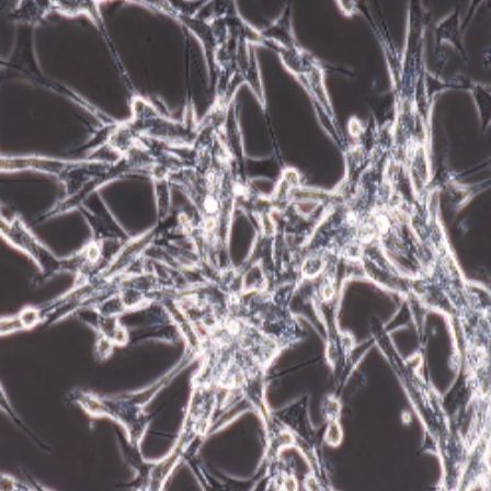 人神经母细胞瘤（IMR-32）