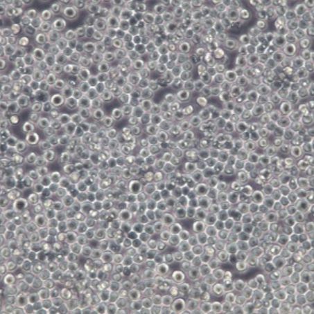 人红白血病细胞（KASUMI-1）