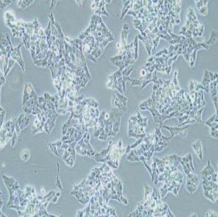 人肾上腺皮质腺瘤细胞(NCI-H295R)