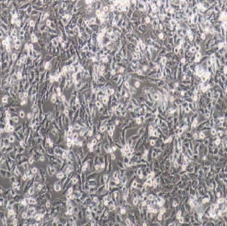 人肺腺鳞癌细胞[NCI-H1703（H1703）]